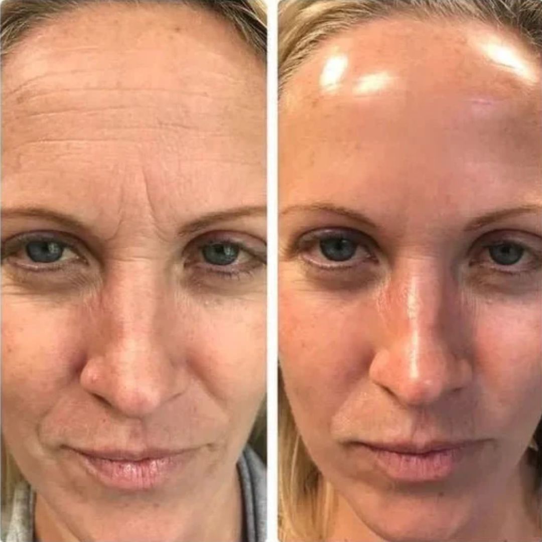 DewCell™ Collagen Veil